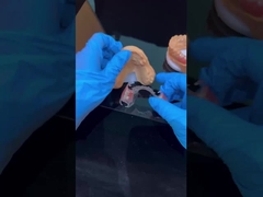 Cuadro claro Acrílico Metal Cuadros de dentadura parcial Alta estética Laboratorio dental de China