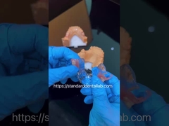 FDA Cobalt Cromo de alta estética marco transparente parcial