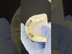 Métalo fundido post Core Corona Cocr Retención exacta completa Zirconia Bruxier