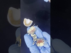 Marco de fundición de cobalto cromo personalizable con pegatinas muy buenas