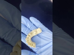 Coronilla de zirconia de contorno completo para un ajuste perfecto / confort estético