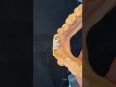 Dientes dentales PFM Puente de Maryland Alta estética Certificado FDA