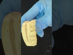 Coronilla de zirconio de contorno completo/alta estética natural y puente dental de zirconio de ayudita personalizado