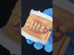 Modelo de impresión en 3D Alta estética Dental TCS Valplast Flexible Dentes parciales Dental Laboratorio