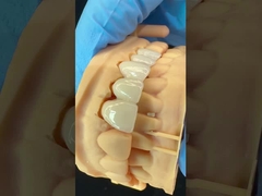 Coronilla de zirconio de contorno completo/alta estética natural y puente dental de zirconio de ayudita personalizado