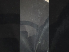 Dentaduras con apoyo de implantes de titanio Dentaduras de precisión Ivoclar sobre implantes