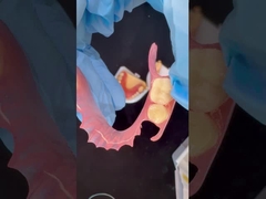 Modelo de impresión en 3D Alta estética Dental TCS Valplast Flexible Dentes parciales Dental Laboratorio