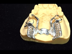 Las aleaciones metálicas parcialmente el cobalto y el cromo las dentaduras Ivoclar Scheftner Confortable China laboratorio dental